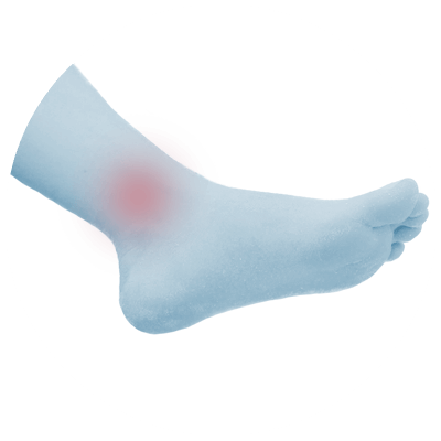 Ankle joint